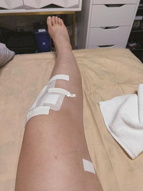 库卢社媒发文:一瘸一拐是因为膝盖进行了一次小手术,现在很好